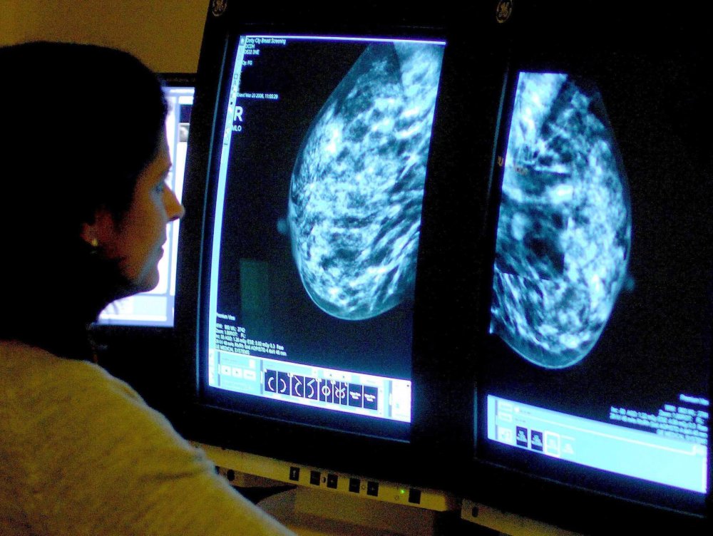 Image: A consultant analyzing a mammogram