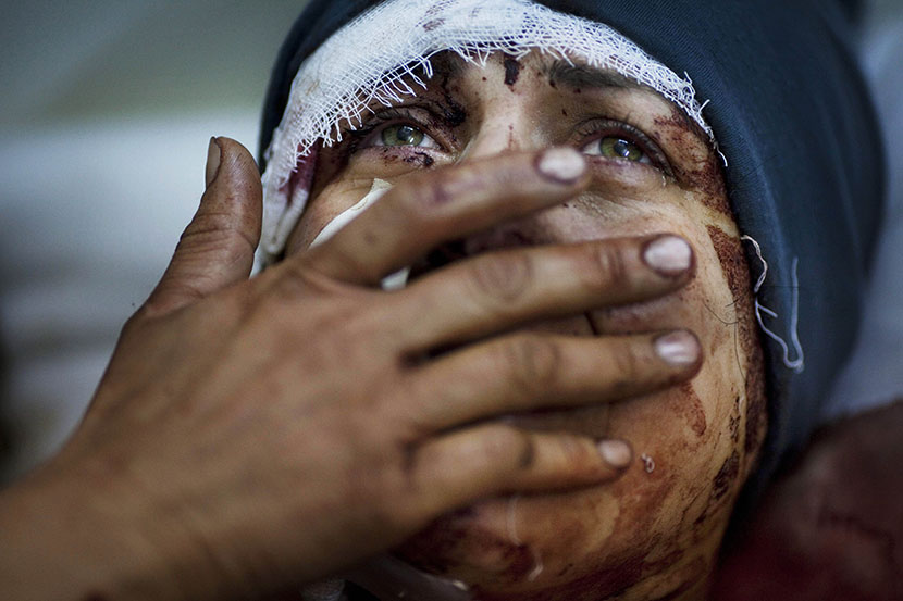 In this March 10, 2012 file photo, Aida cries as she recovers from severe injuries after the Syrian Army shelled her house in Idlib, north Syria. Aida's husband and two of her children were killed after their home was shelled. (Photo by Rodrigo Abd/AP)